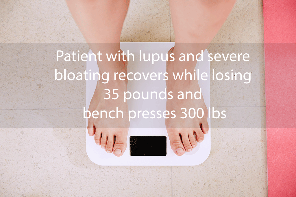 Patient with lupus and severe bloating recovers while losing 35 pounds and bench presses 300 lbs