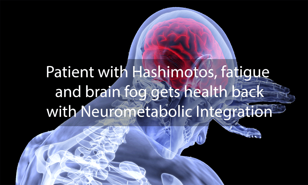 Patient with Hashimotos, fatigue and brain fog gets health back with Neurometabolic Integration