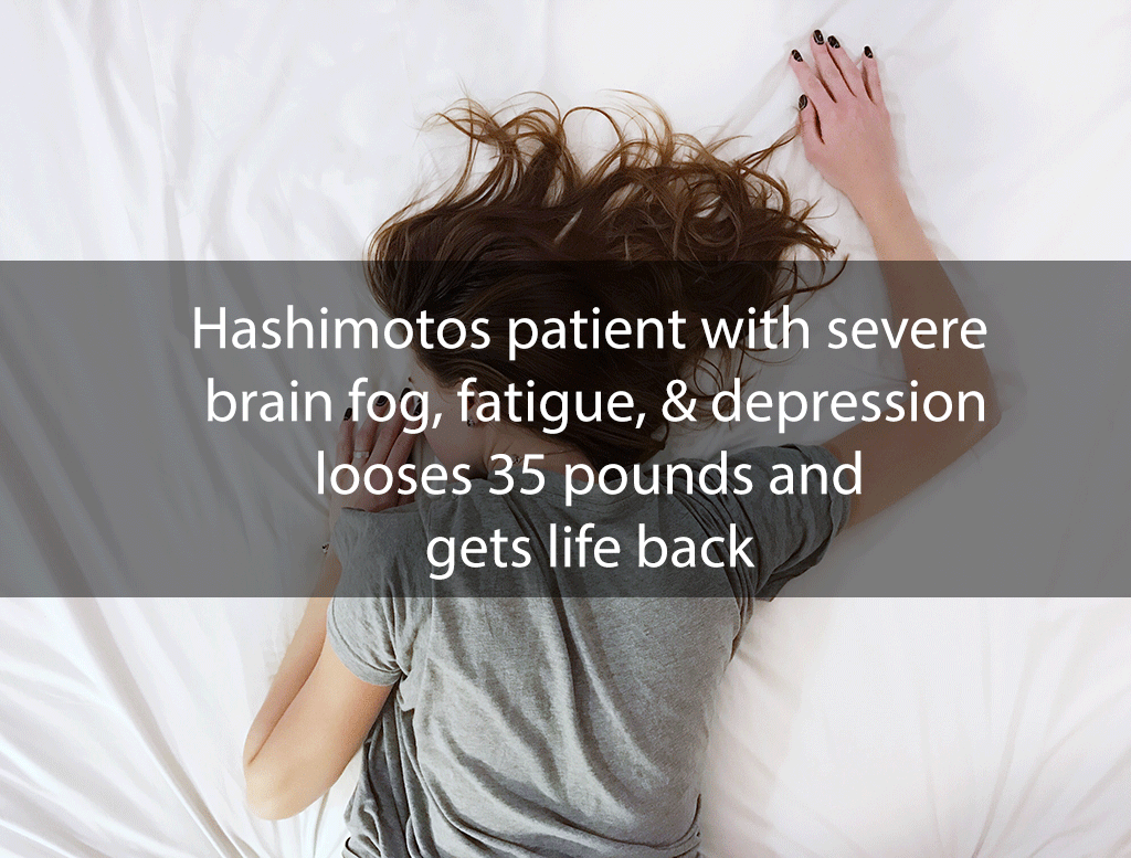 Hashimotos patient with severe brain fog, fatigue, & depression looses 35 pounds and gets life back