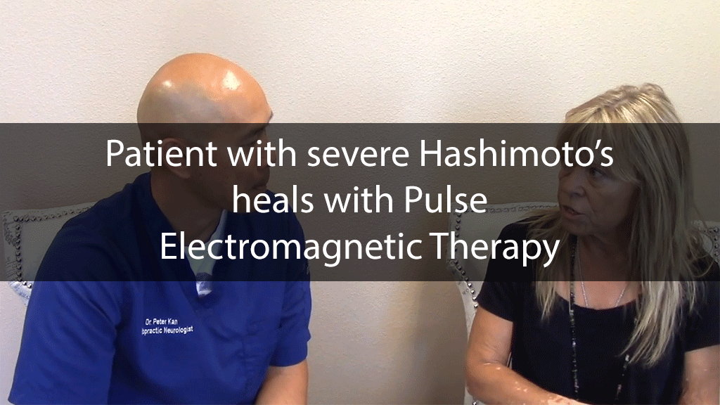 Patient with severe Hashimoto’s heals with Pulse Electromagnetic Therapy